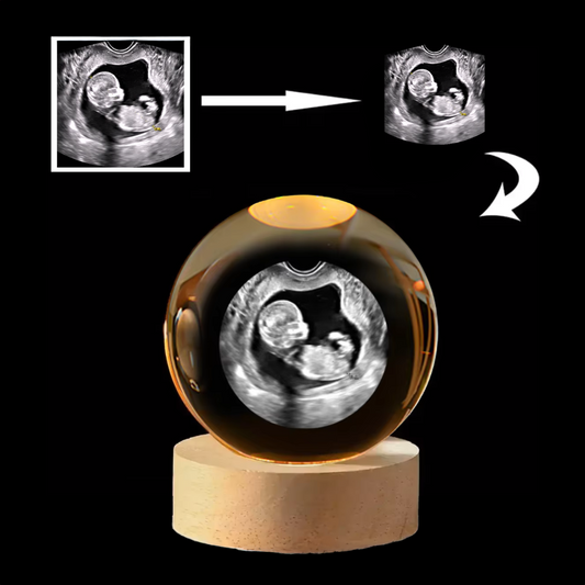 First Glance | Personalized Ultrasound Crystal Ball Keepsake