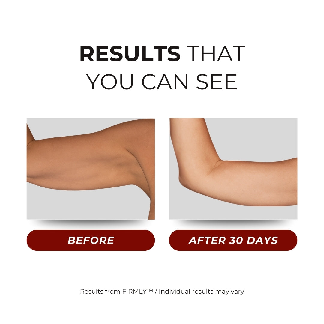 FIRMLY™ ARMS | Dual-Wavelength Red Light Wrap with 3-Layer Lift Technology™