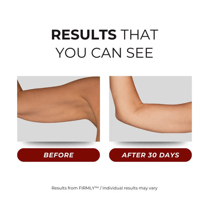 FIRMLY™ ARMS | Dual-Wavelength Red Light Wrap with 3-Layer Lift Technology™