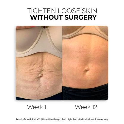 FIRMLY™ | Upper Care Kit with Dual-Wavelength Red Light & 3-Layer Lift Technology™